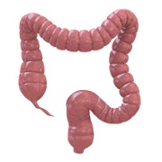 Colon Cancer related image